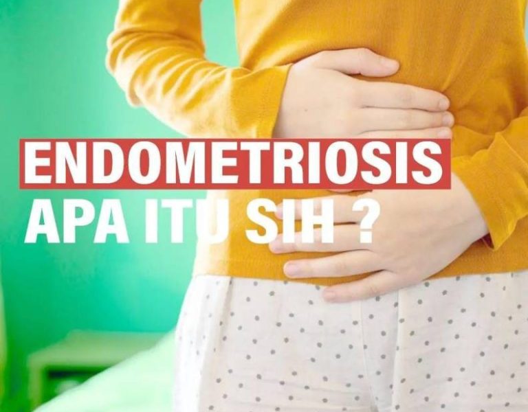 Dinkes Kota Makassar: Endometriosis Itu Apasih?